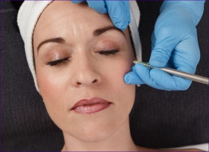 Karboksiterapija za lice: što je to u kozmetologiji, kako napraviti neinvazivni postupak
